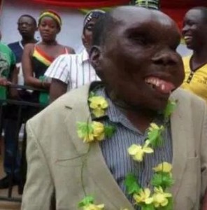 Uganda's Ugliest Man, Godfrey Baguma has a rare medical condition.